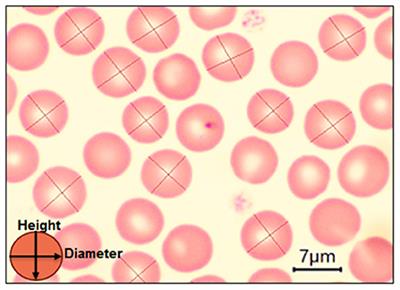 Red blood cells morphology and morphometry in adult, senior, and geriatricians dogs by optical and scanning electron microscopy